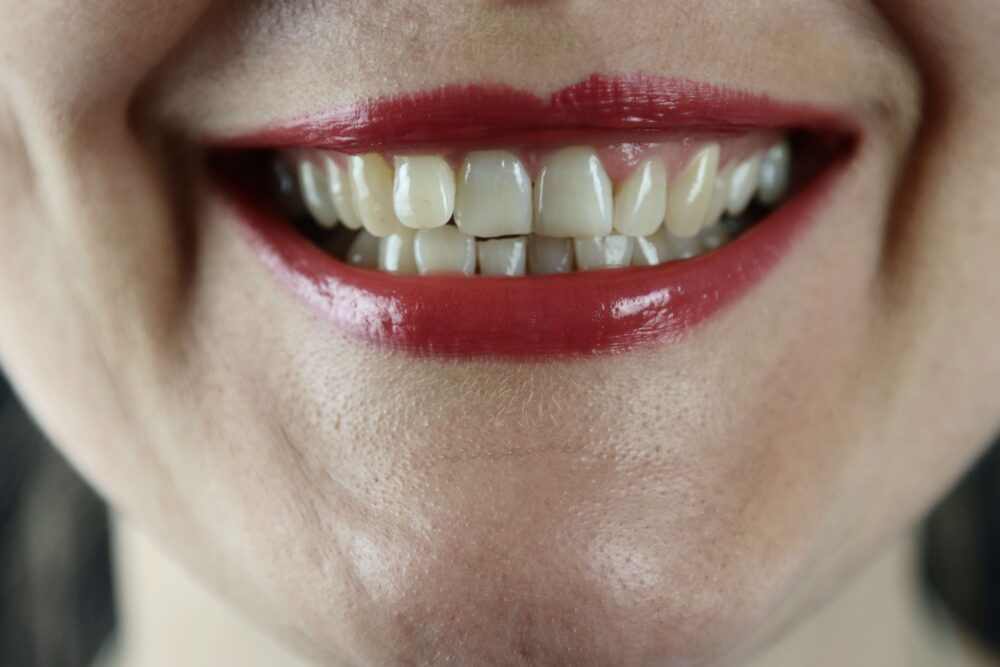 歯相学からみた歯の特徴と性格の関係